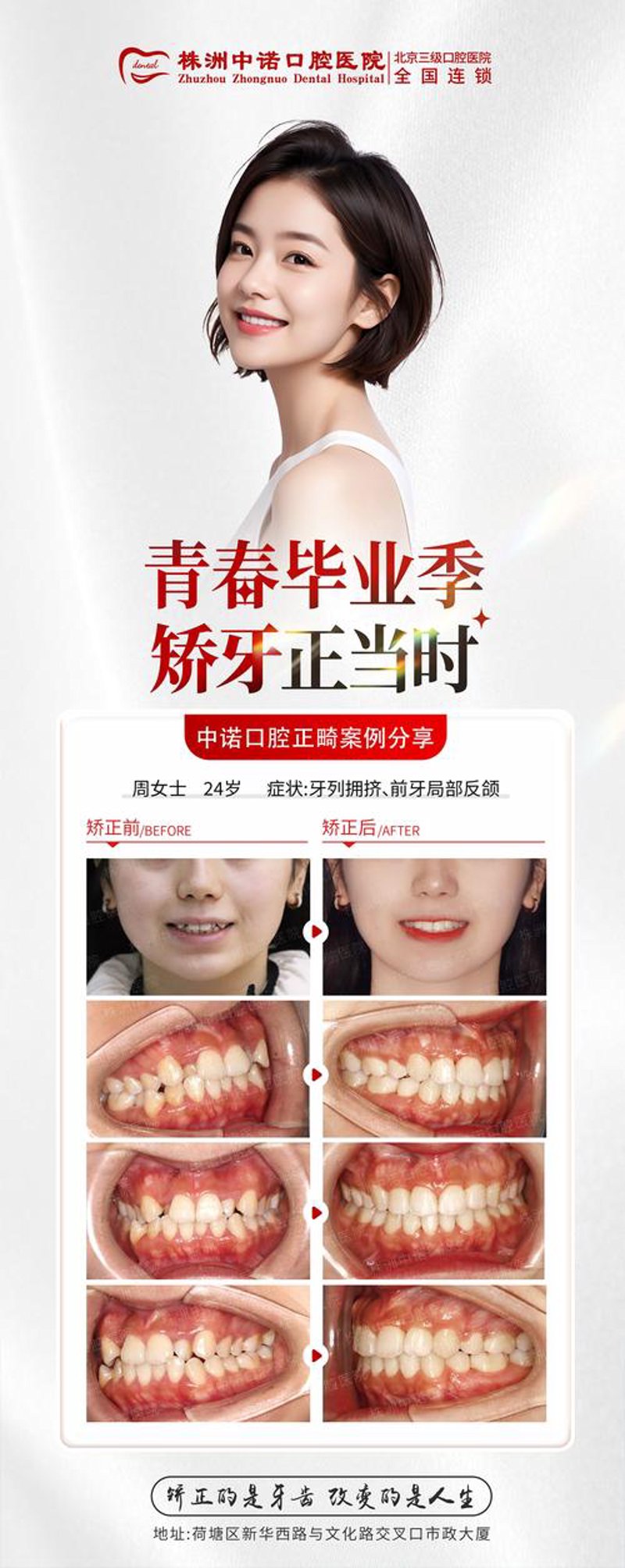 株洲牙齿矫正