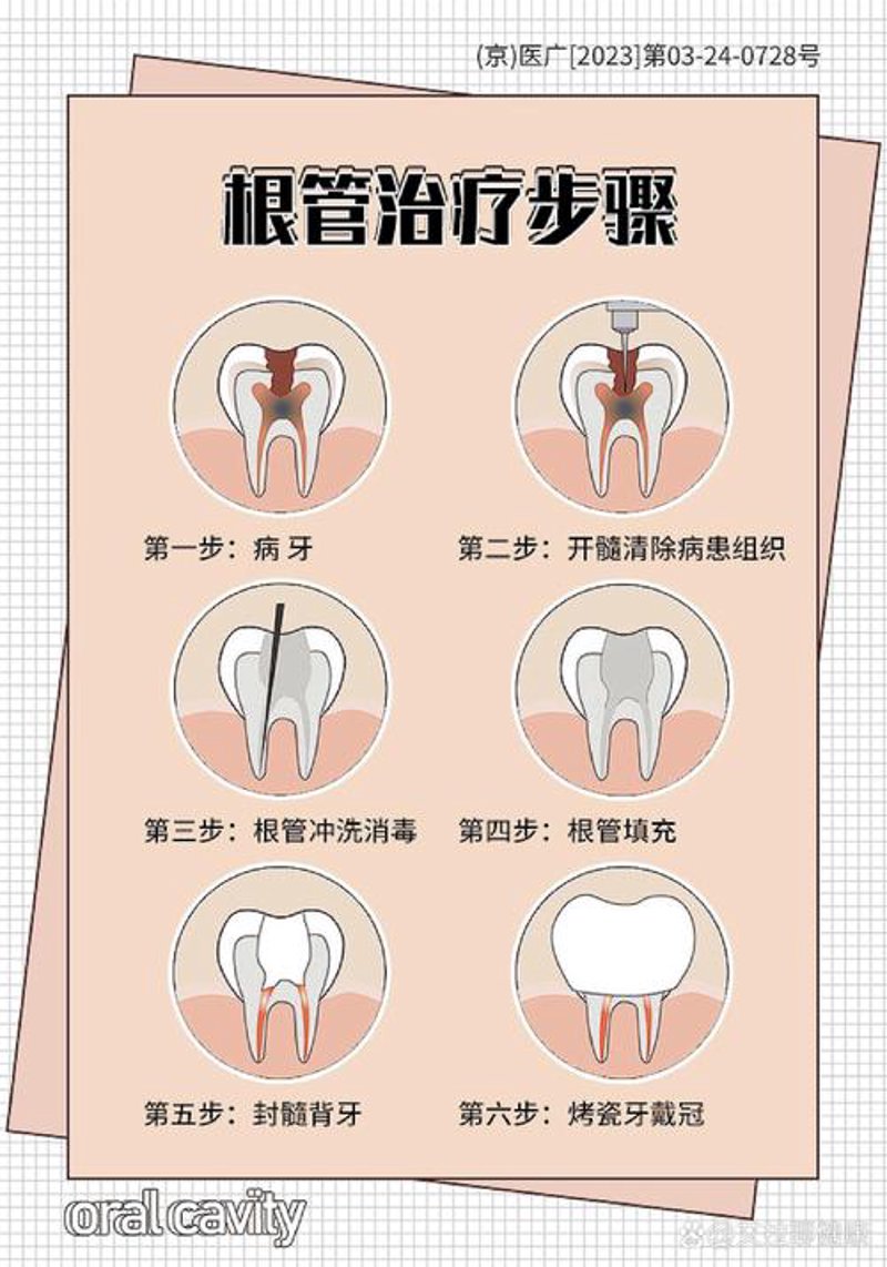 选择专业的口腔护理服务——牙美丽口腔