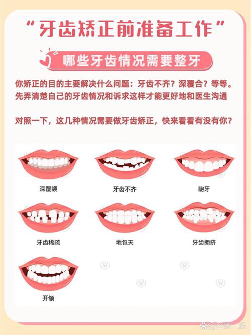 洗牙的正确打开方式：让你的口腔远离烦恼